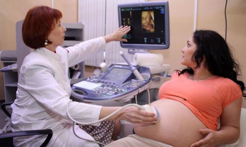3D ultrasound at 24 weeks