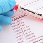 анализ крови пациента для определения маркеров рака