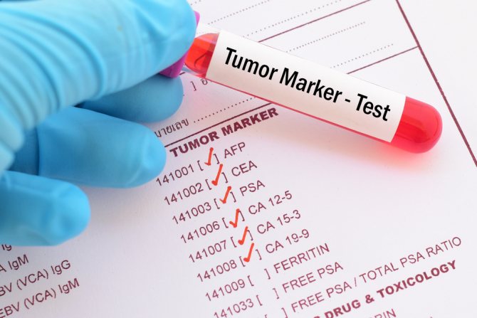 patient&#39;s blood test to determine cancer markers