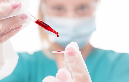 Venous blood drug testing is the most informative