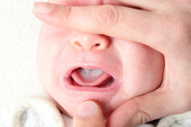 White coating on baby&#39;s tongue