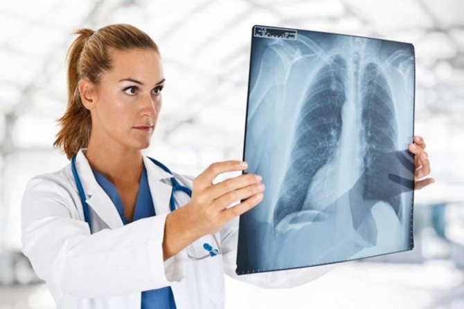 What is the difference between X-ray and fluorography?