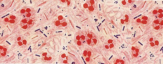 Clostridium perfringens и их споры