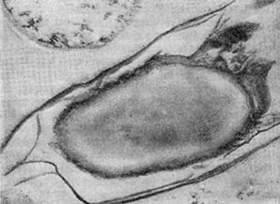 Clostridium perfringens under a microscope