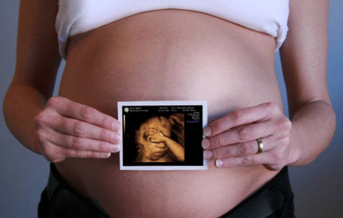 Girl with photo of fetus
