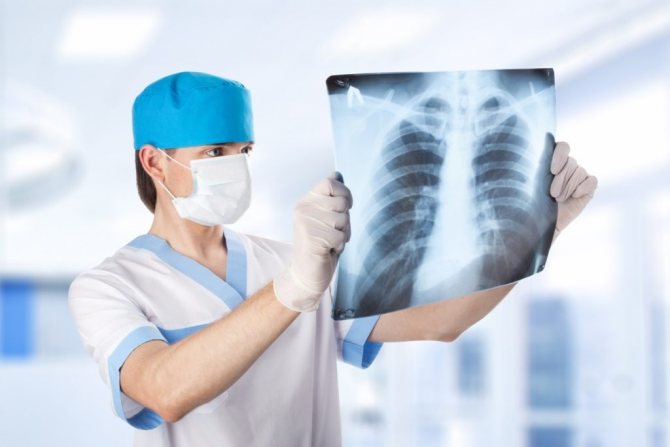 Doctor looking at chest x-ray in hospital