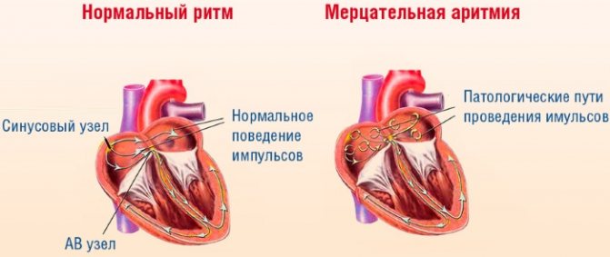 ЭХО (эхокардиография) сердца. Что показывает, нормальные показатели, как делают