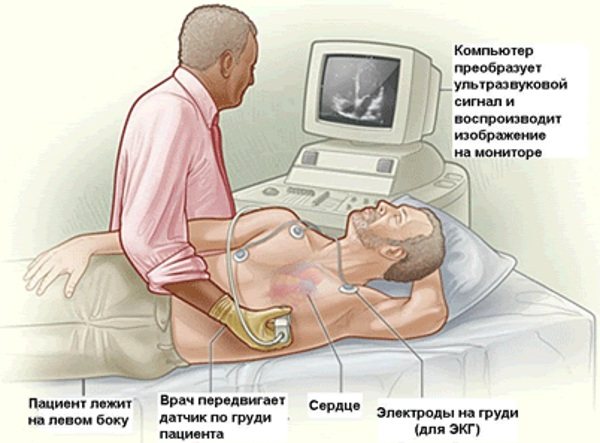 ECHO (echocardiography) of the heart. What shows normal indicators, how they do it 