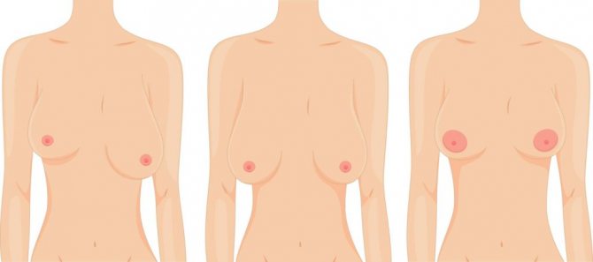 Форма груди после грудного вскармливания