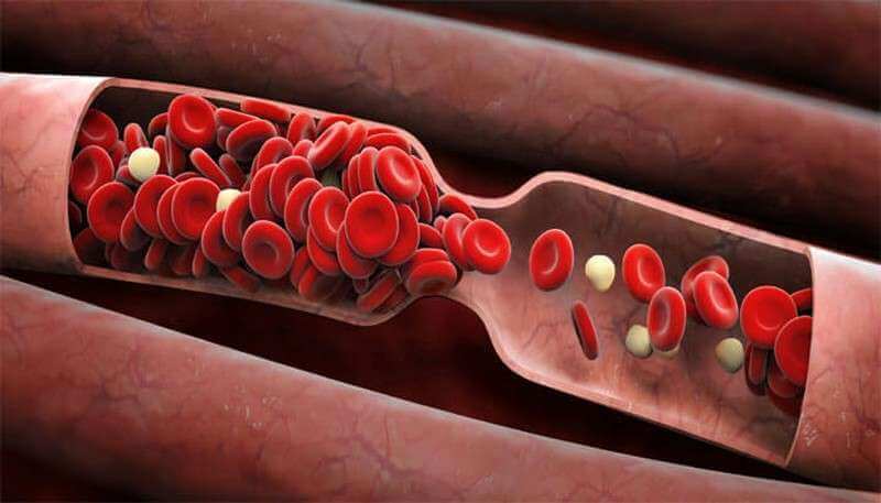Thick Blood: Symptoms You Shouldn&#39;t Ignore!