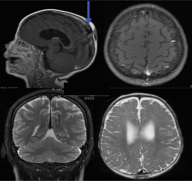 Image 1 - MRI scan of the brain in different projections - Family Doctor Clinic