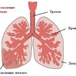 Изображение 3: Пневмония - клиника Семейный доктор