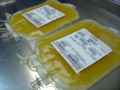 Как быстро поднять тромбоциты в крови после химиотерапии: какие продукты могут повысить тромбоциты