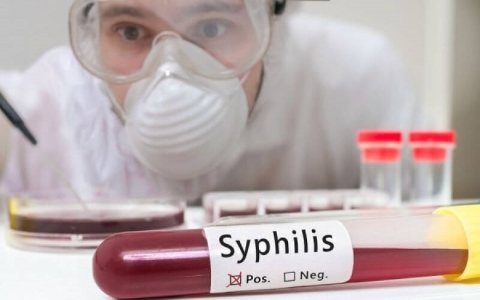 How to get tested for syphilis correctly