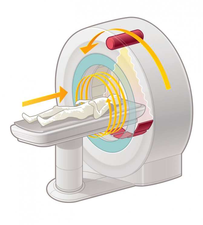 What kind of disk is needed for a CT scan and how to open it at home yourself
