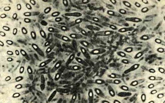 Clostridia can persist for a long time in unfavorable conditions