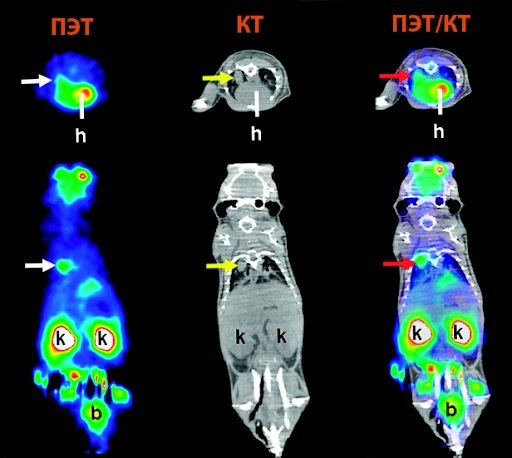 Key differences between PET, PET/CT and CT with contrast