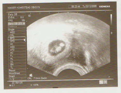 When is an ultrasound of the uterus performed?