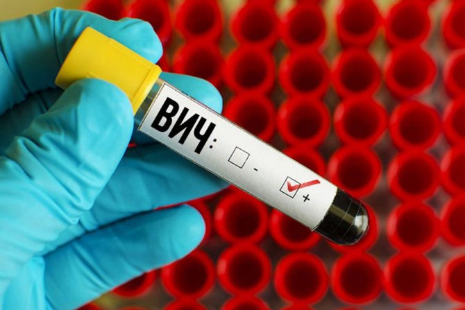 blood for HIV: positive
