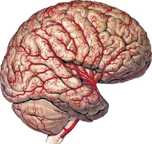 MRI of the brain with blood vessels