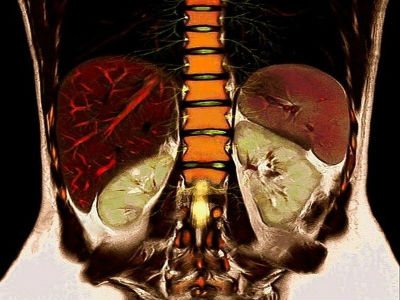 MRI of the abdominal cavity