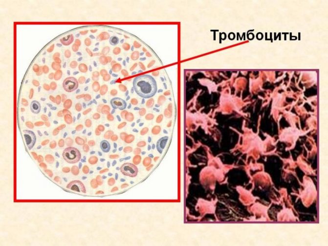 The photo shows what platelets look like in the blood plasma, among the red blood cells.