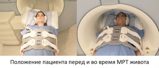 position during abdominal MRI