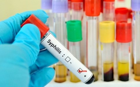 Reasons for a false negative test for syphilis