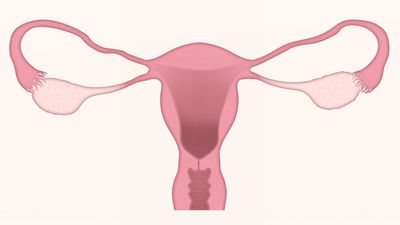 Causes of endometriosis