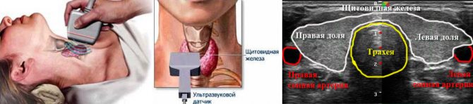 The examination process and ultrasound image on the screen of the thyroid gland