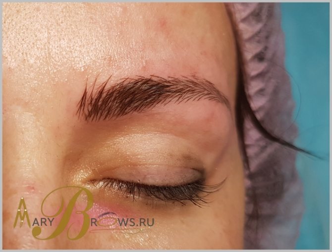Contraindications after microblading