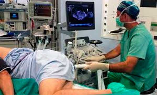 Performing an ultrasound of the prostate