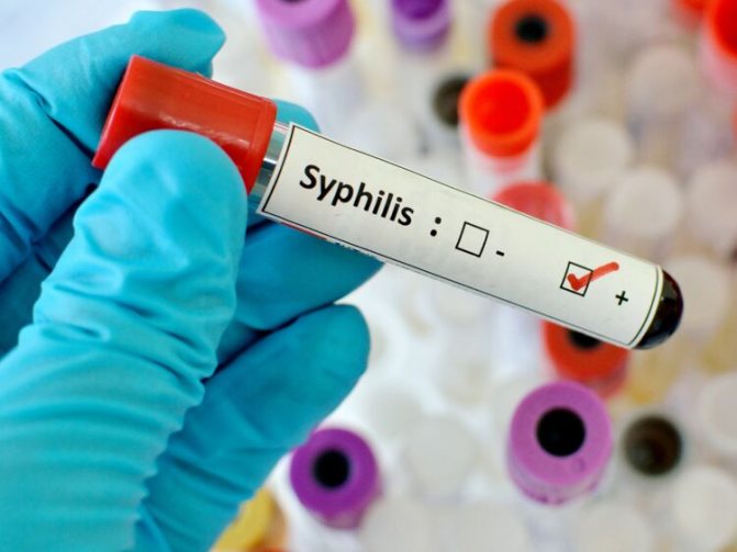 reactions after syphilis