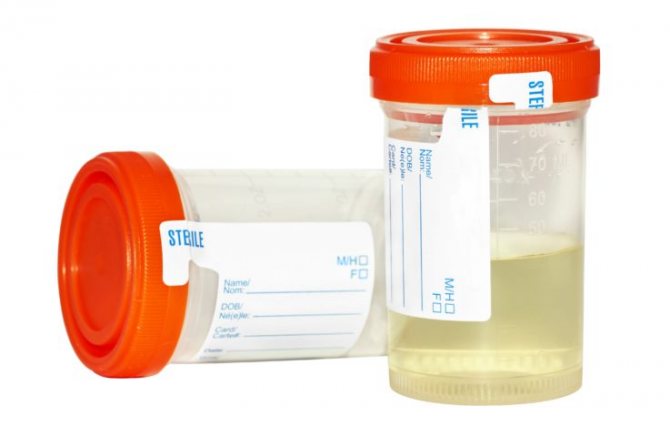 Urine collection