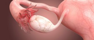 Синдром истощенных яичников: причины появления и диагностика
