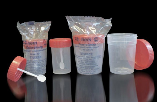 Sterile containers for collecting urine for analysis