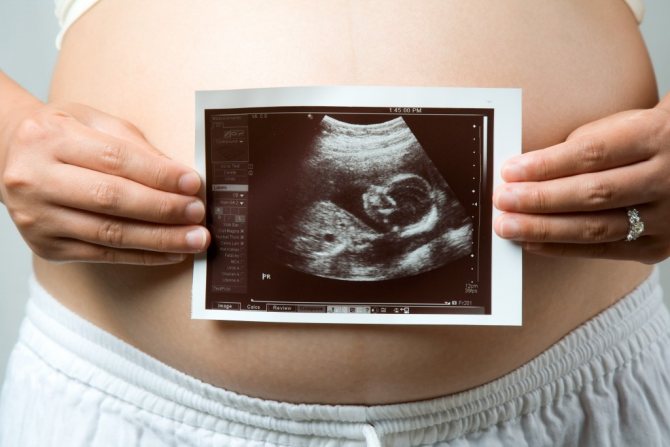 Obstetric ultrasound, first trimester (from 3 to 9 weeks)