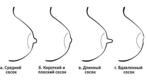 Types of nipples