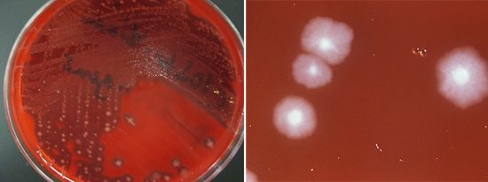 Causative agent of gas gangrene on blood agar