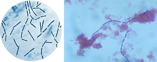pathogens of gangrene under a microscope