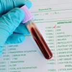Зачем брать анализ крови на кальций